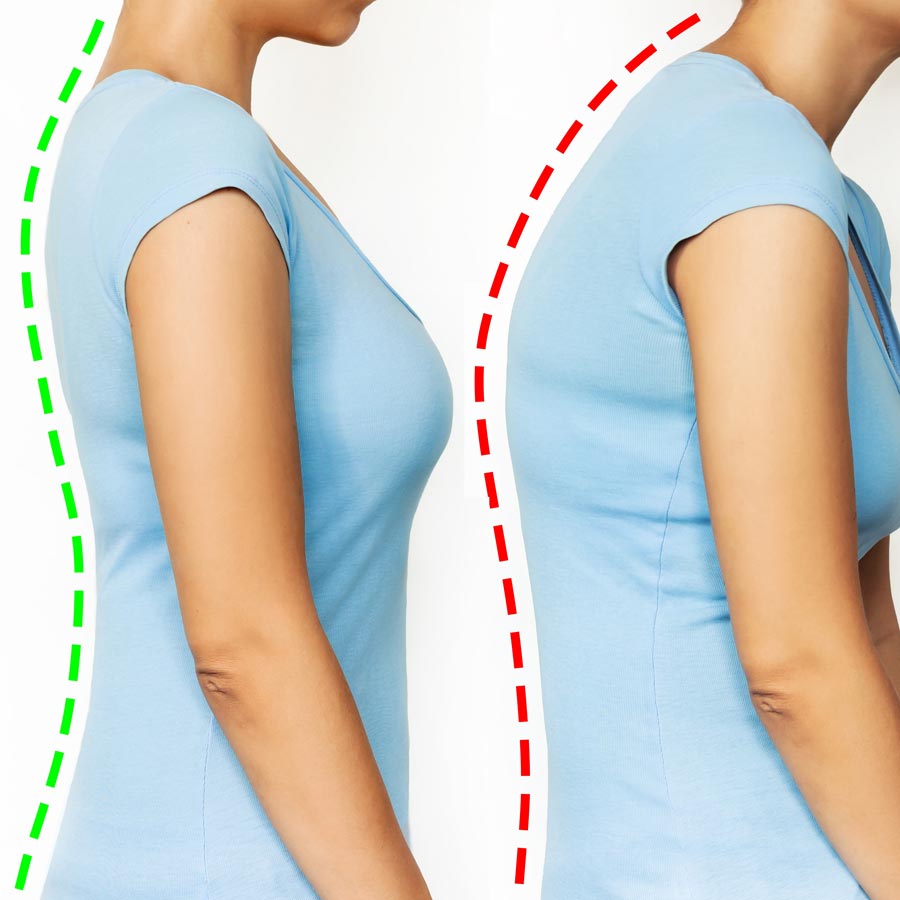 Chiropractic BioPhysics St. Petersburg Florida – Hood Chiropractic Chiropractic BioPhysics St. Petersburg Florida - Hood Chiropractic