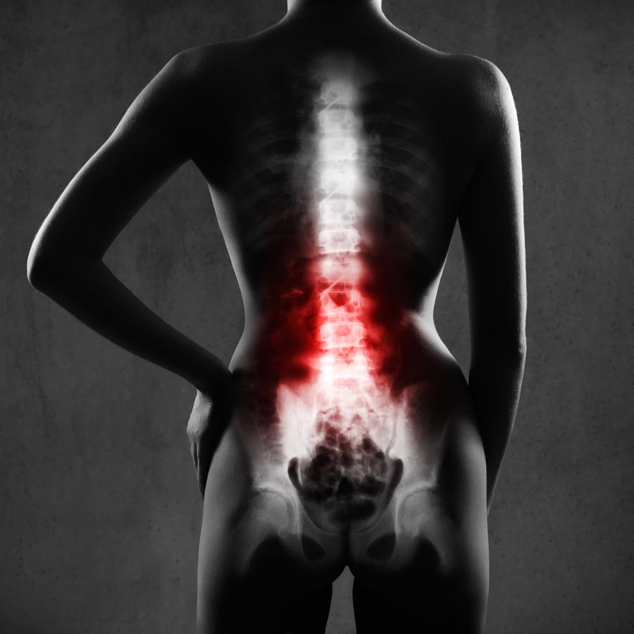 Disc Injury St. Petersburg Florida – Hood Chiropractic Disc Injury St. Petersburg Florida - Hood Chiropractic