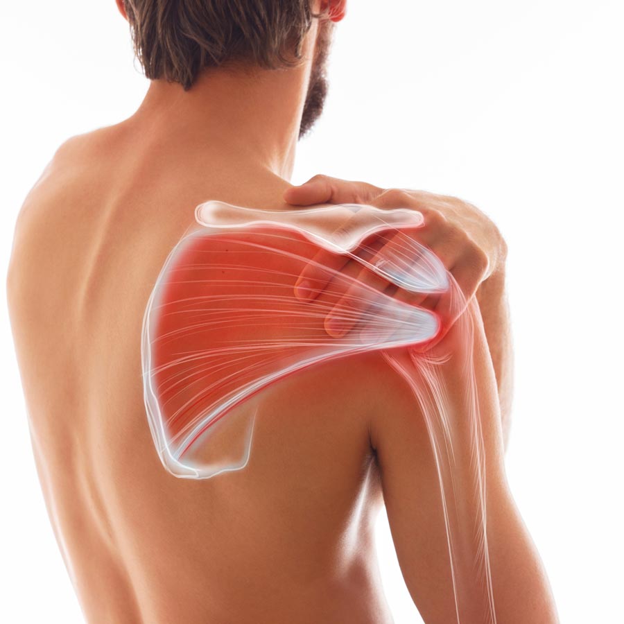 Shoulder Pain St. Petersburg Florida – Hood Chiropractic Shoulder Pain St. Petersburg Florida - Hood Chiropractic