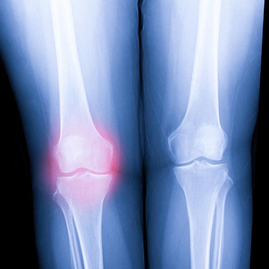 Work Injury St. Petersburg Florida - Hood Chiropractic