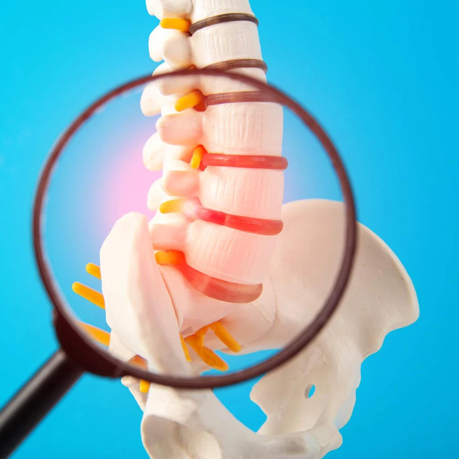 Sciatica St. Petersburg Florida - Hood Chiropracticc